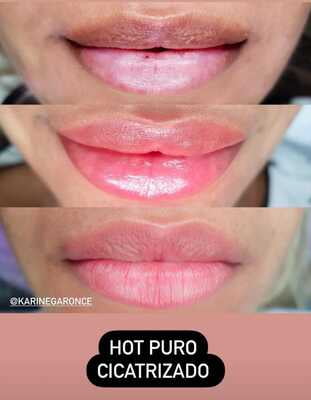 HOT 15ML HOT 15ML