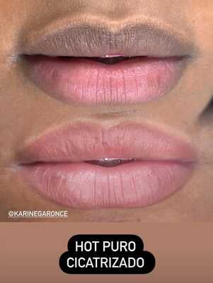 HOT 15ML HOT 15ML